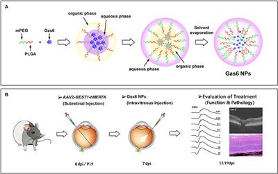 Sustained Release of Gas6 via mPEG-PLGA Nanoparticles Enhances the Therapeutic Effects of MERTK Gene Therapy in RCS Rats